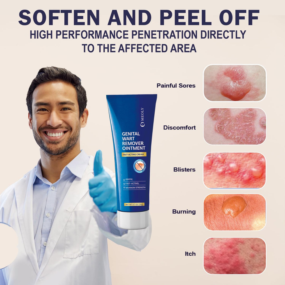 Salicylic Acid Wart Remover Cream T81193