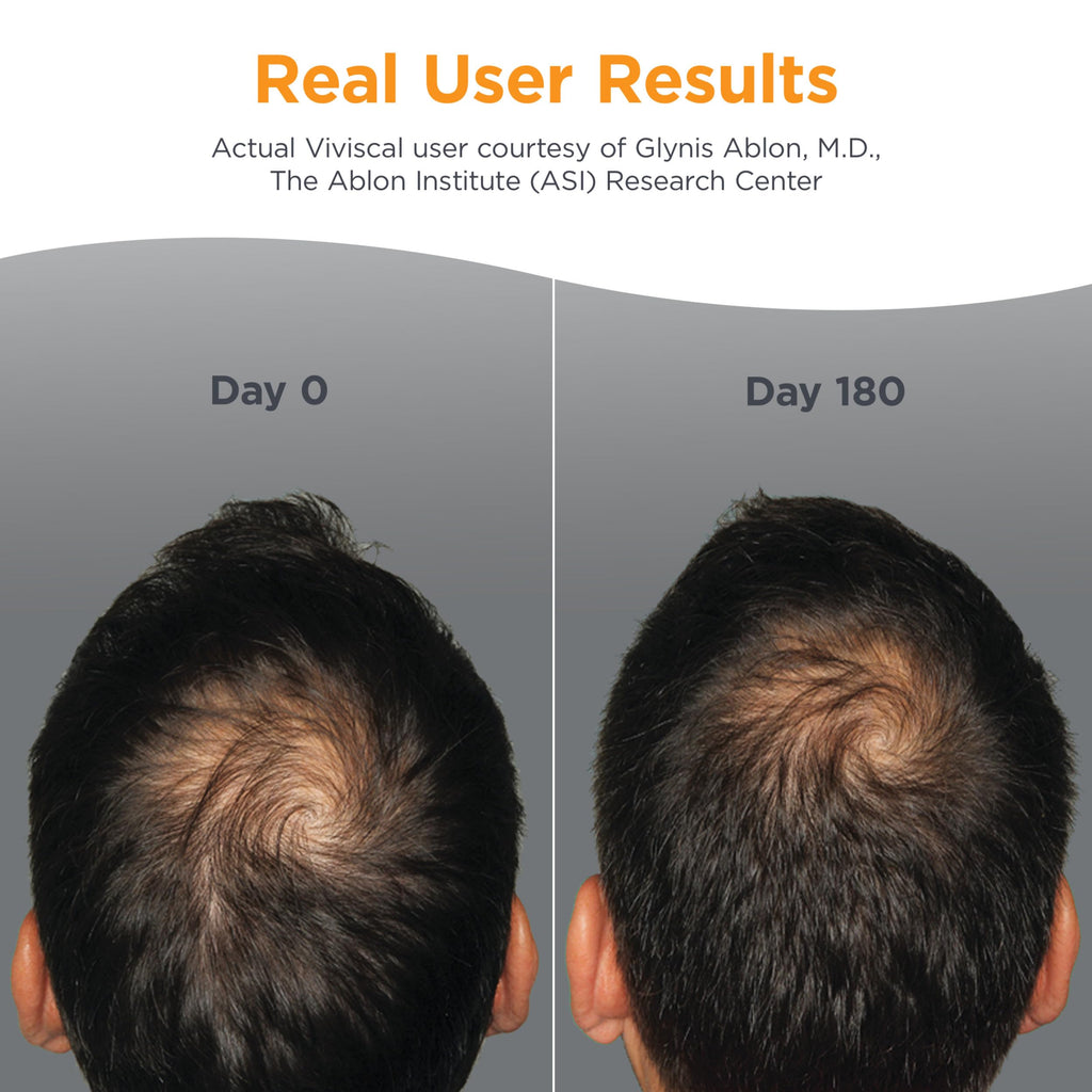 Men's Hair Growth Supplements 180 Tablets M5886