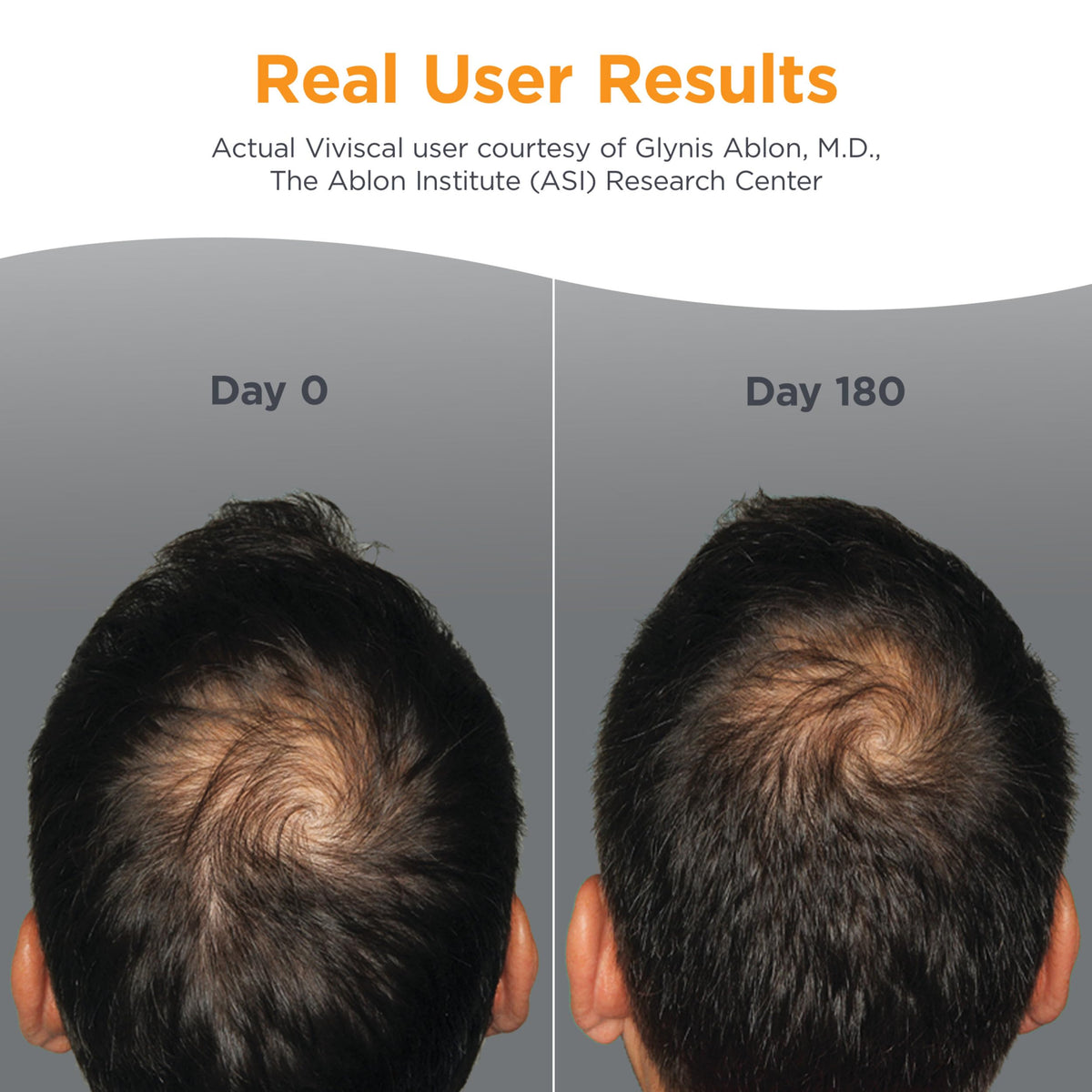 Men's Hair Growth Supplements 180 Tablets M5886